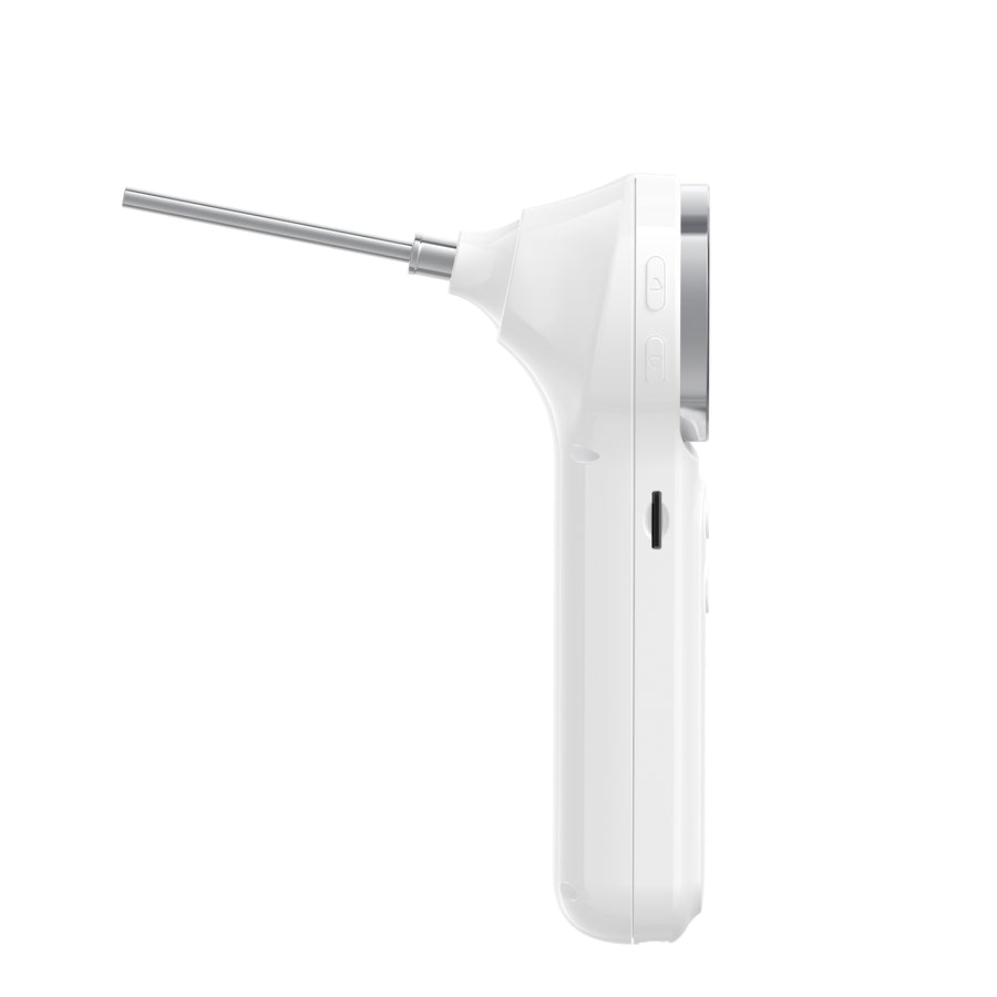 Ear, Nose, & Throat Smart Otoscope